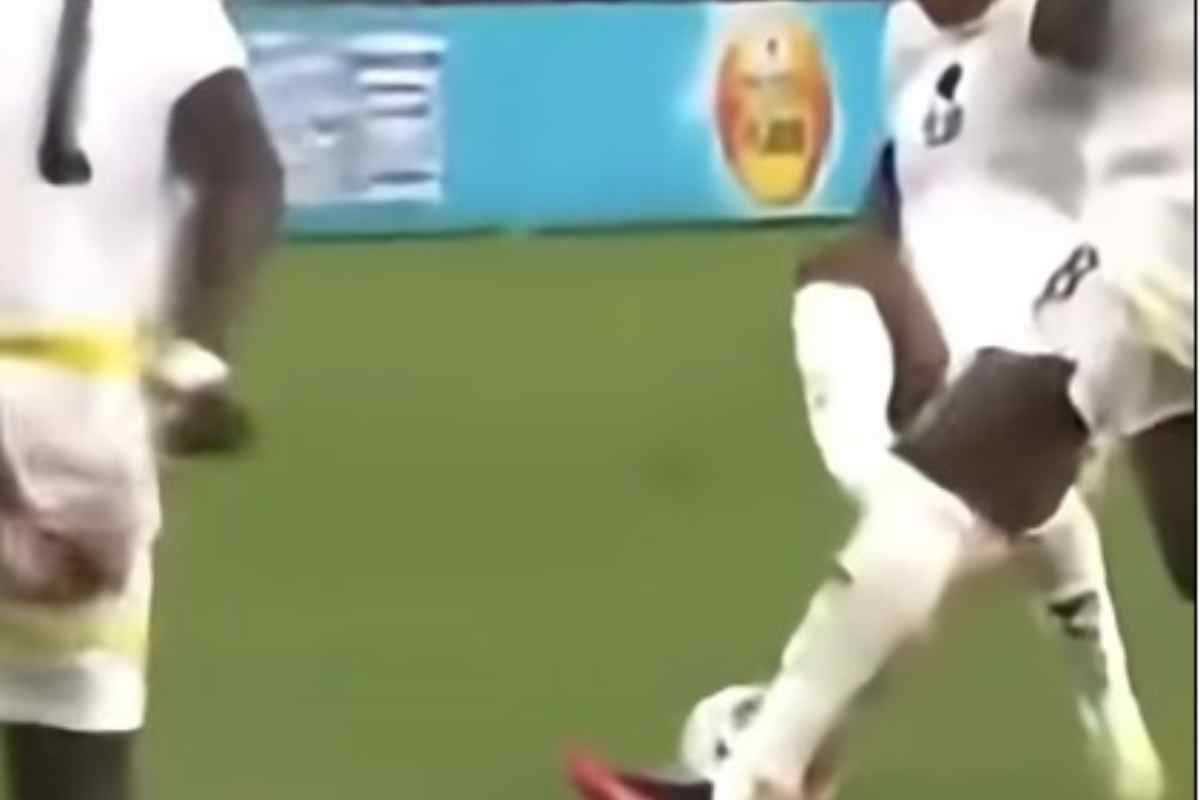 Fratture Nazionale infortunio Ambulanza